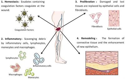 ROS-scavenging materials for skin wound healing: advancements and applications